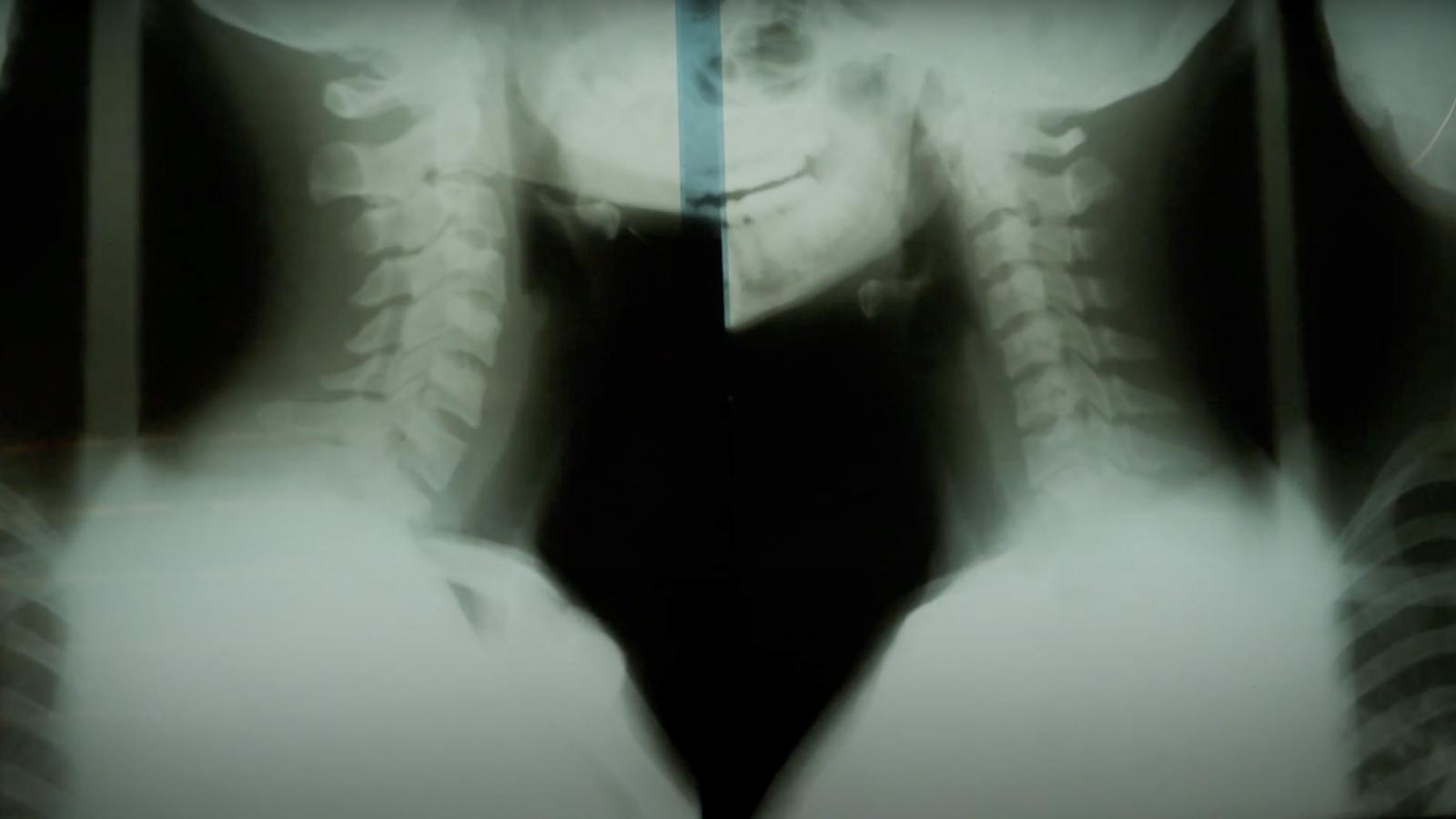 The Truth Is Far From Romantic - Initial Findings from our Kayayei Chiropractic Research